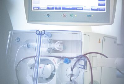 Ein Gerät, das bei der Dialyse verwendet wird