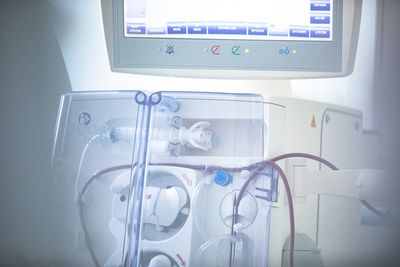 Dialyse-Gerät Ein Gerät, das bei der Dialyse verwendet wird